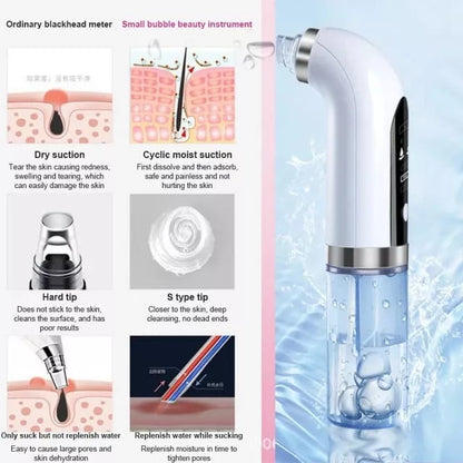 Extractor de espinillas