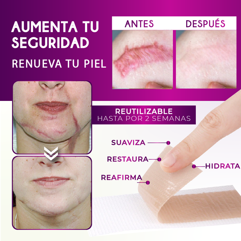 CINTA ANTI CICATRICES