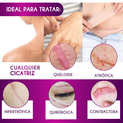 CINTA ANTI CICATRICES
